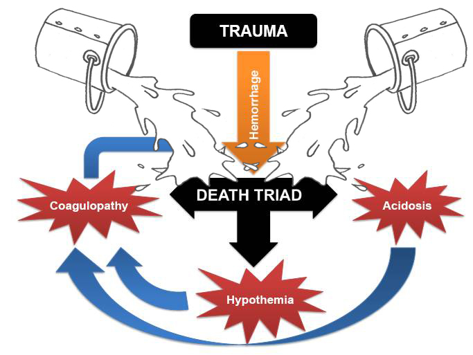 Emergency Live | Fluid resuscitation in bleeding trauma patient: are you aware of wich is the right fluid and the right strategy?