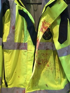 tony's blood-soaked uniform