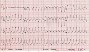 case2ecg