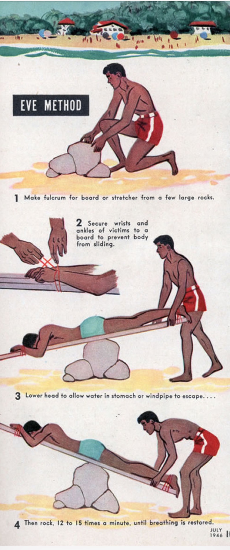 Emergency Live | Story of CPR: the contribution of Dr. Eve's Method of Artificial Resuscitation