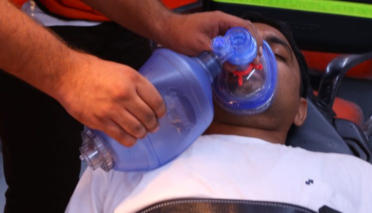 Emergency Live | Manual Ventilation, 5 Things to Keep in Mind image 1