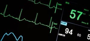 ECG-MONITOR-DEFIBRILLATOR