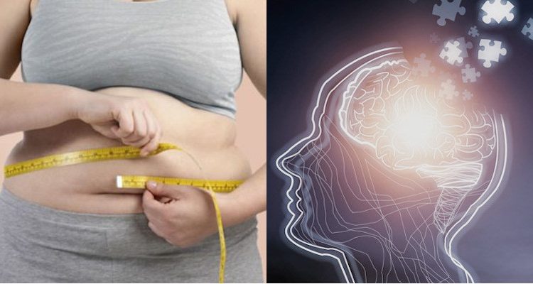 Emergency Live | Are obesity and Alzheimer related? Investigation on the mid-life obesity and dementia relationship