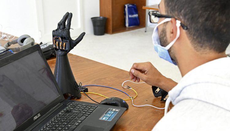 Emergency Live | Tunisia, 3D printed bionic hand: grows as the amputee child grows