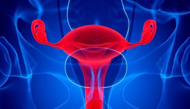Emergency Live | Ovarian cancer, an interesting research by the University of Chicago Medicine: how to starve cancer cells?