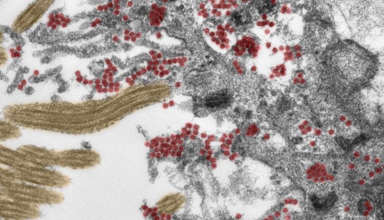 COVID-19, by what mechanisms does the coronavirus reach the brain? Scientific publication by the Charité University of Berlin in Nature Neuroscience