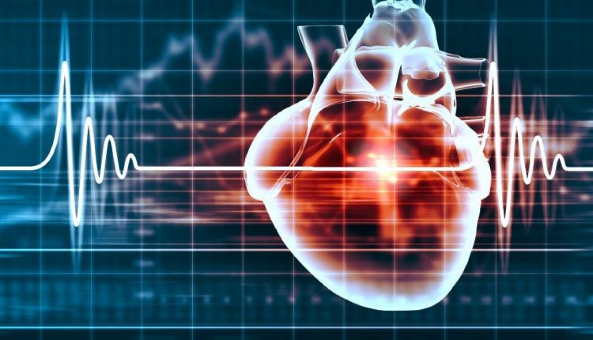 儿科 Bambino Gesu 的心动过速新消融技术