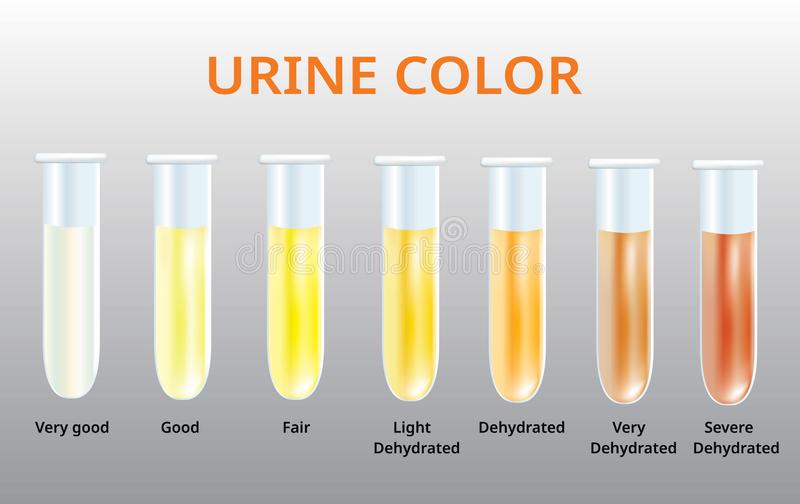 urinare frecventă la bărbați urină limpede