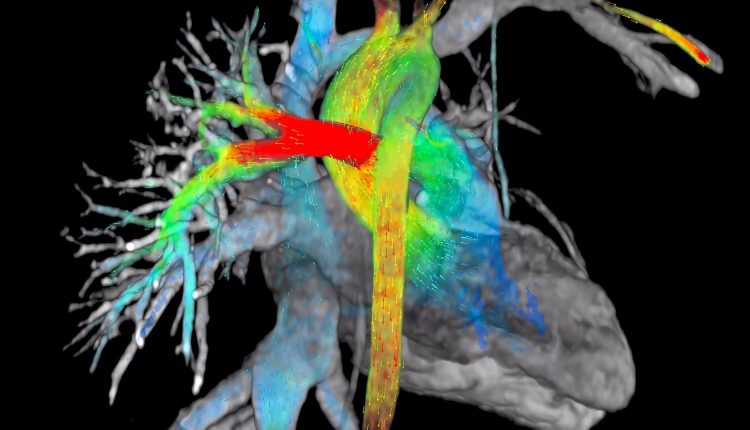 MRI