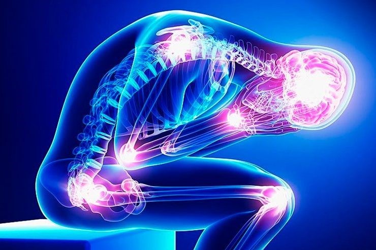 Hat man bei Fibromyalgie Rückenschmerzen?