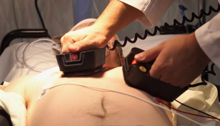 Patient procedures: what is external electrical cardioversion?