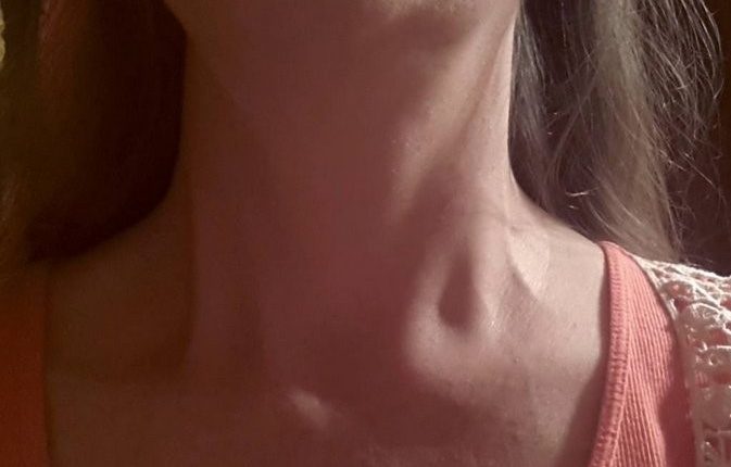 Lymph nodes