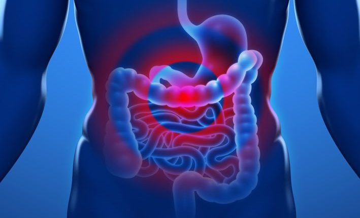 Irritable bowel syndrome: the symptoms it can manifest itself with
