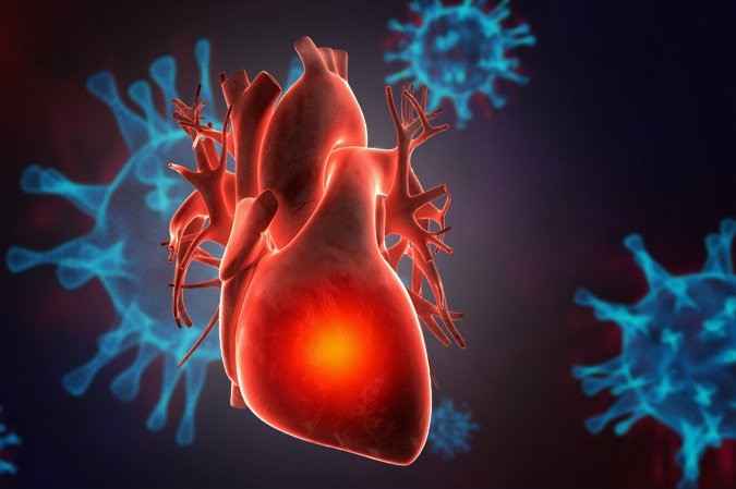 Szív- és érrendszeri betegségek nőknél – rendhagyó szűrés, aggasztó eredmények | immoconcept.hu