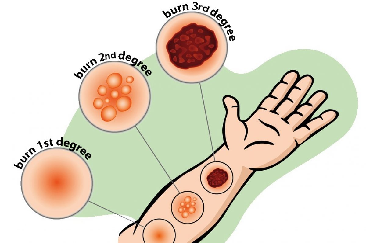 Investing papilloma classification of burns kasse cryptocurrency