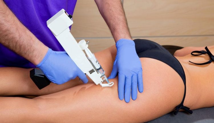 Analgesic mesotherapy: what it is, when it is needed and how it is performed