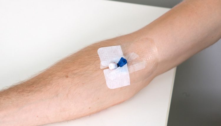 What is intravenous Cannulation (IV)? The 15 steps of the procedure