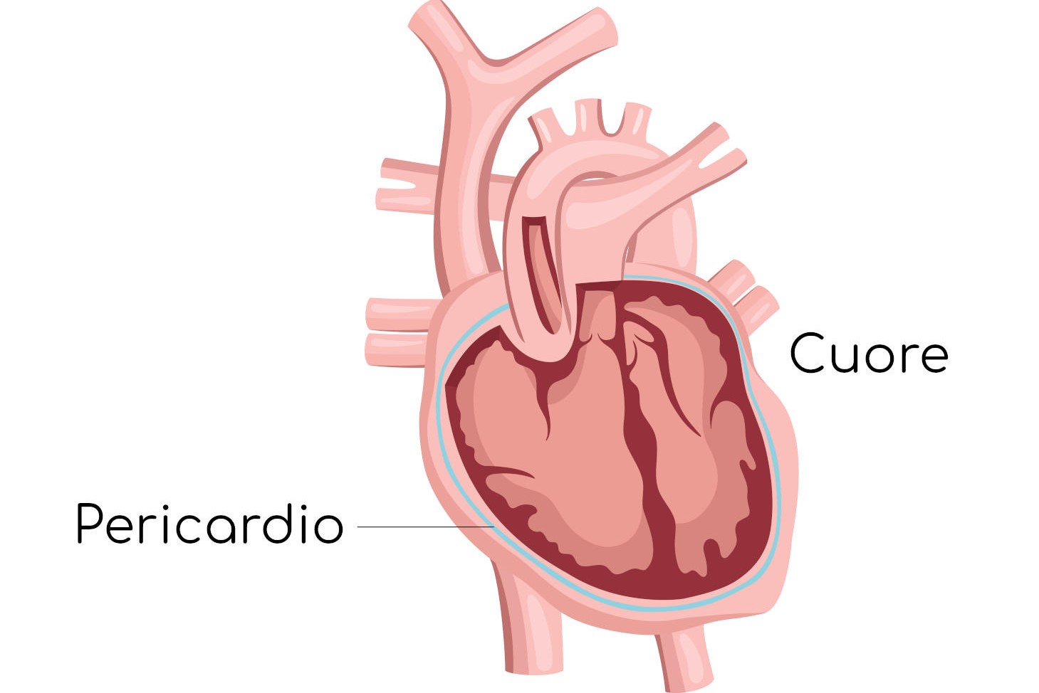 pericarditis