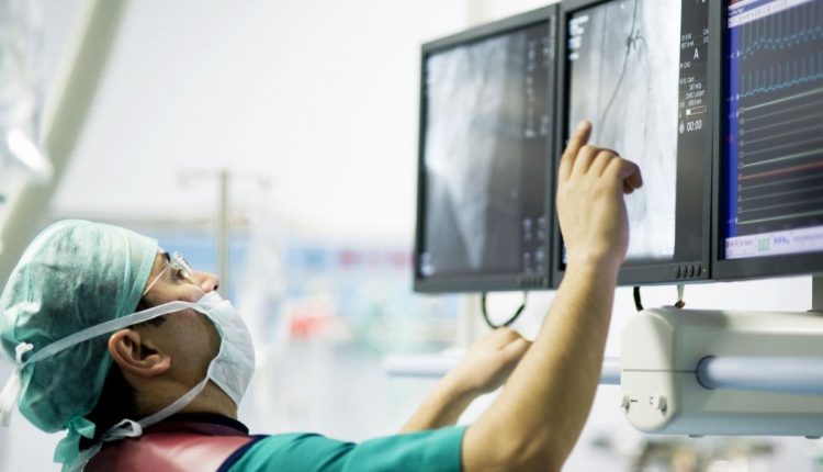 アテローム切除術とは何ですか?