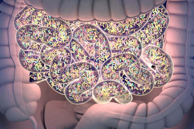 Sobrecrecimiento bacteriano intestinal