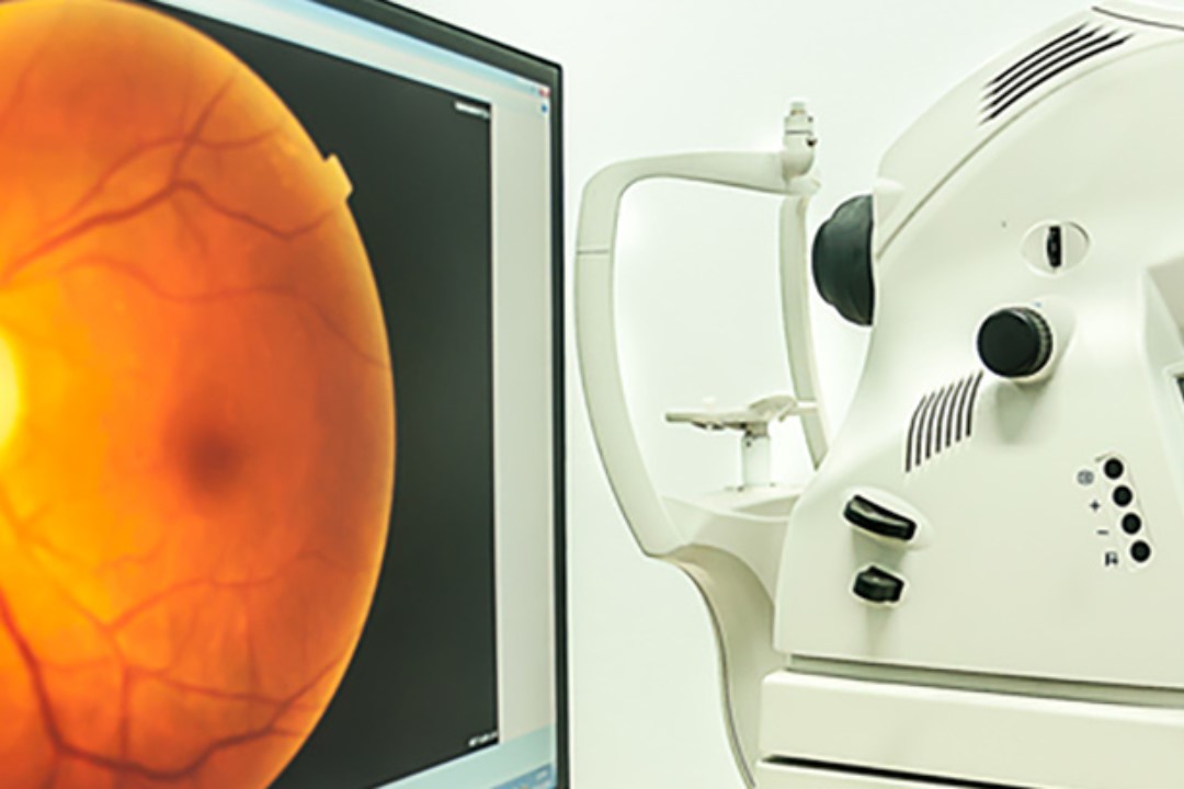 er retinal fluorangiografi, og hvad er risiciene?