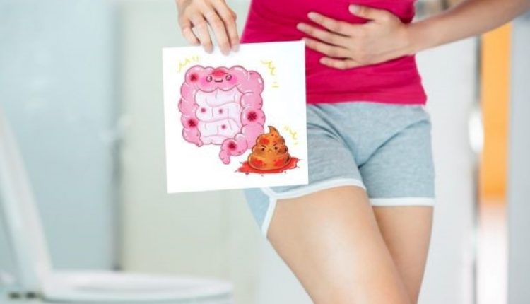 Red blood in the stool: when to worry?