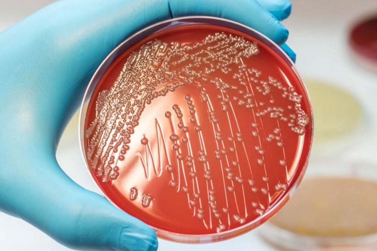 Escherichia coli: symptoms, diagnosis and treatment