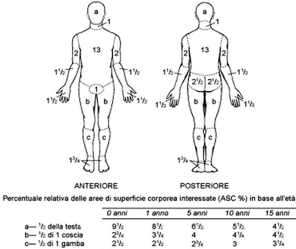 Calculating the surface area of a burn the rule of 9