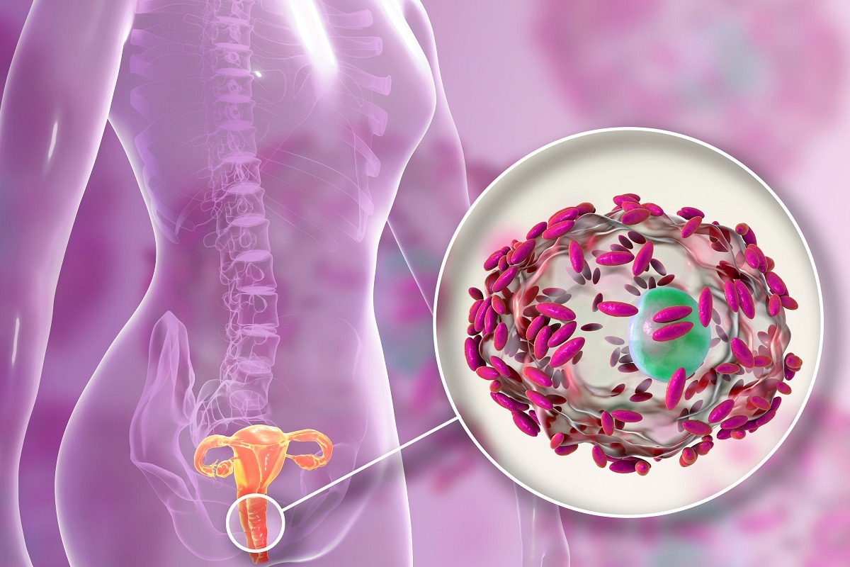 Bacterial vaginosis, how to defend yourself?