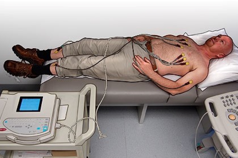 Смэкг что это. Электроды на пациенте ЭКГ. Электрокардиография наложение электродов. Электрокардиография у женщин. ЭКГ фото.