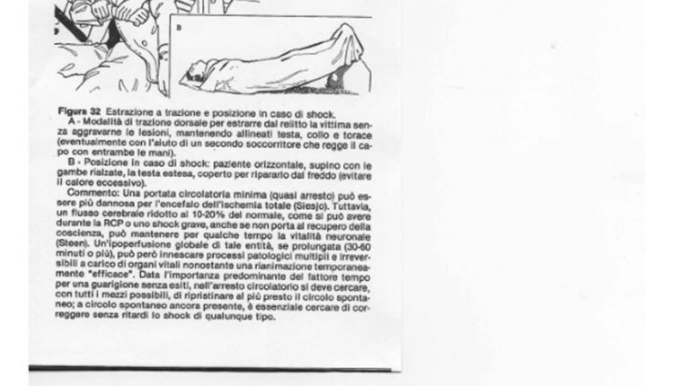 A destra posizione anti shock (da RCPC di Peter Safar 1981)